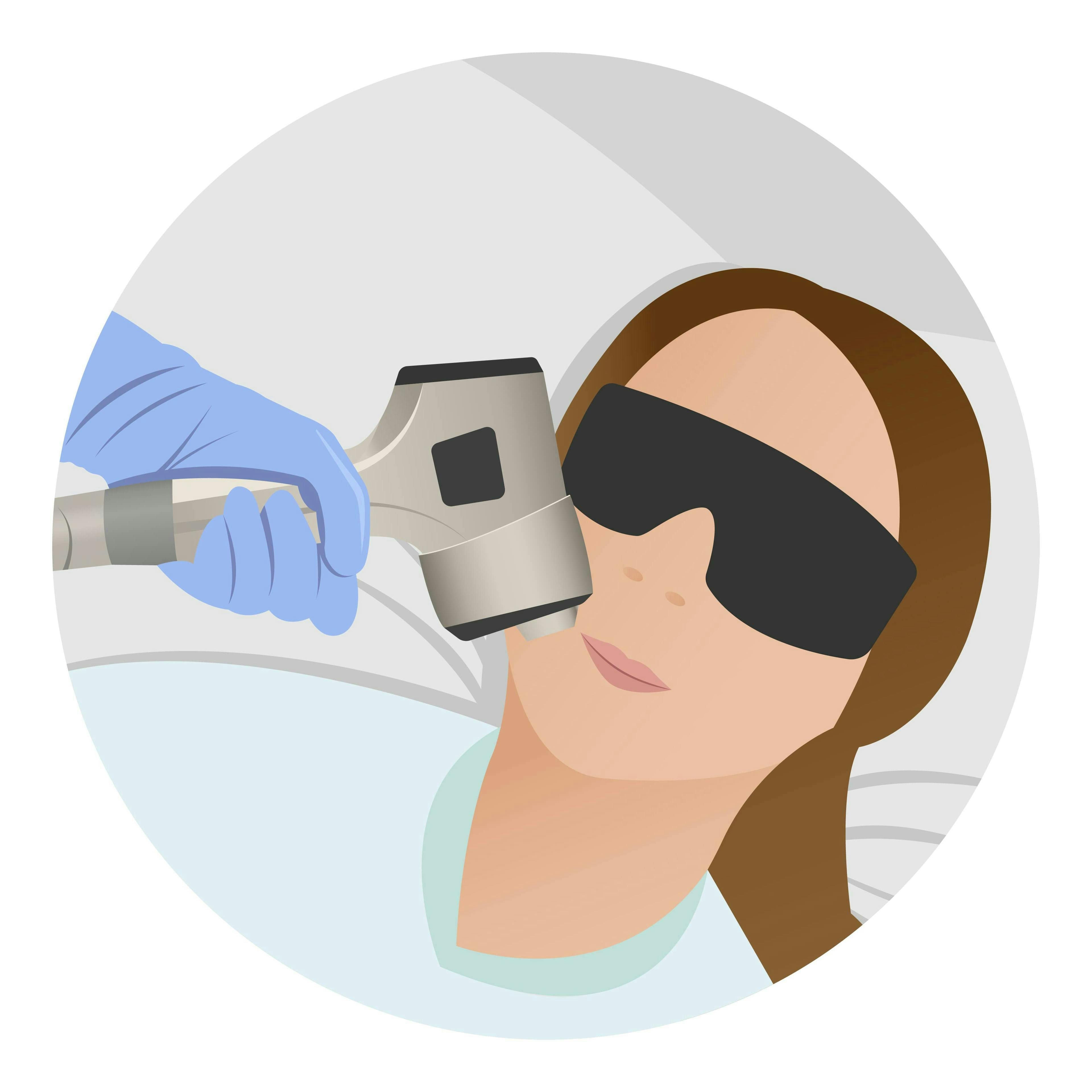 Dauerhafte Entfernung von Gesichtshaaren durch Laserbehandlung in Steyr